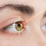how long after cataract surgery can you wear eye makeup