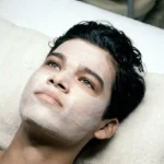 Facial Rejuvenation